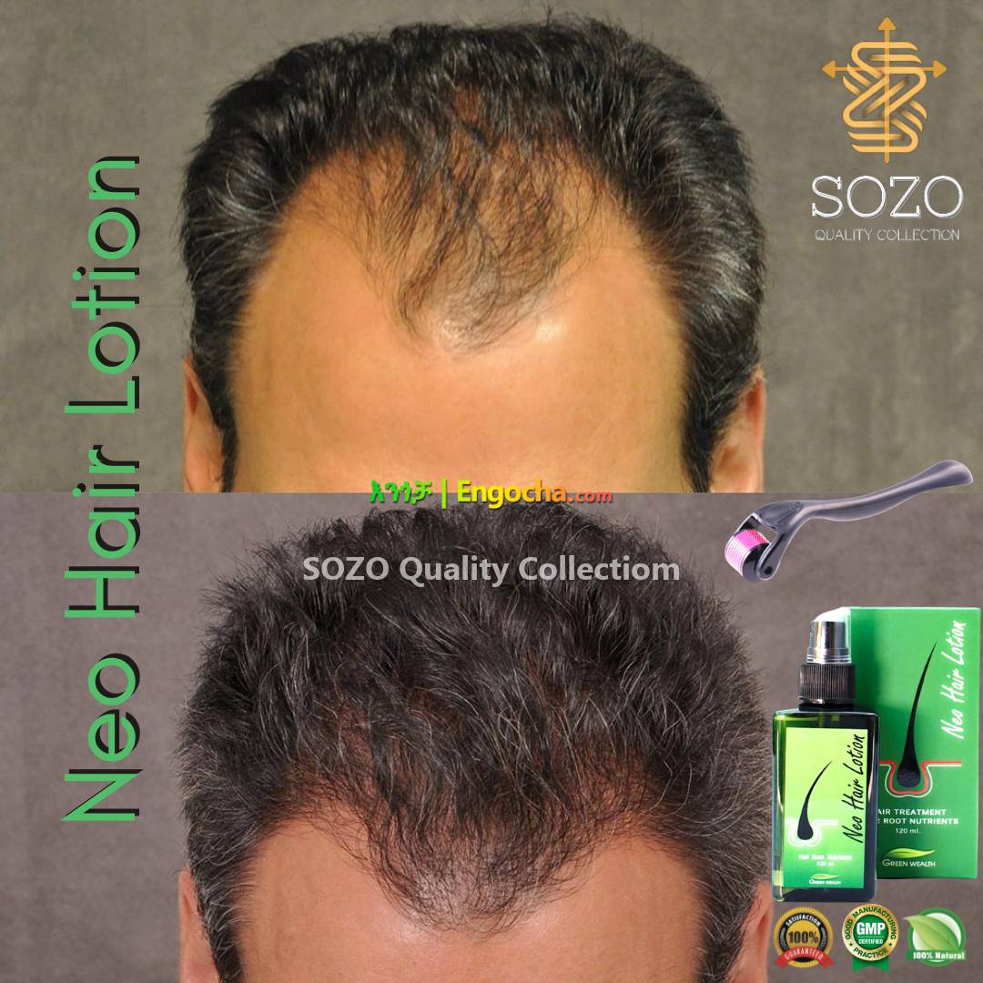 Original from Thailand Neo Hair Lotion / Anti-Hair Loss Tonic, Beauty &  Personal Care, Hair on Carousell
