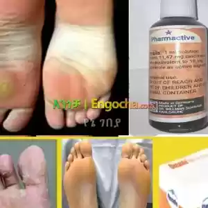 anti fungal (የእግር ፈንግስ ማጥፊያ) Price in Ethiopia