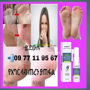 Debacteris foot spray የእግር ላብ ጠረን ያጠፋል Price in Ethiopia