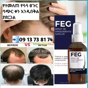 Feg የተመለጠ የሳሳ ፀጉር እንዲበቅል ያደርጋል Price in Ethiopia