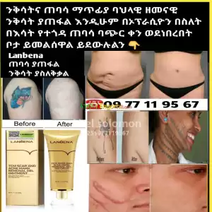 Lanbena ጠባሳ ያጠፋል Price in Ethiopia