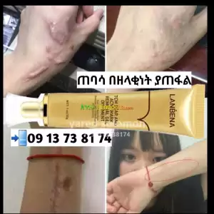 Lanbena ጠባሳ ያጠፋል Price in Ethiopia