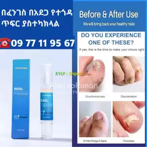 Nail የተበላሸ ጥፍር ያስተካክላል Price in Ethiopia
