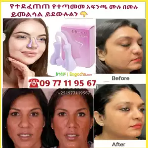 Nose correct አፍንጫ ያስተካክላል Price in Ethiopia
