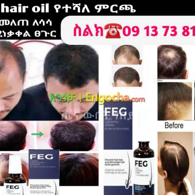 feg hair oil የተመለጠ የሳሳ ፀጉር እንዲበቅል ይረዳል