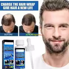 የፀጉር ማብቀያ Price in Ethiopia