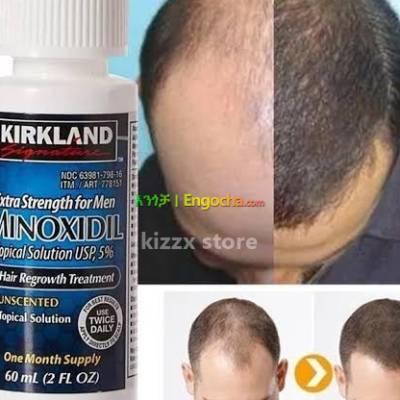 minoxidil hair growth