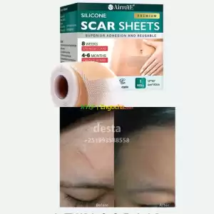 Silicone scar sheet Price in Ethiopia
