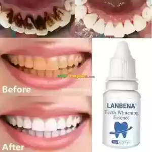 የበለዘ ጥርስን የሚያነፃ  Price in Ethiopia